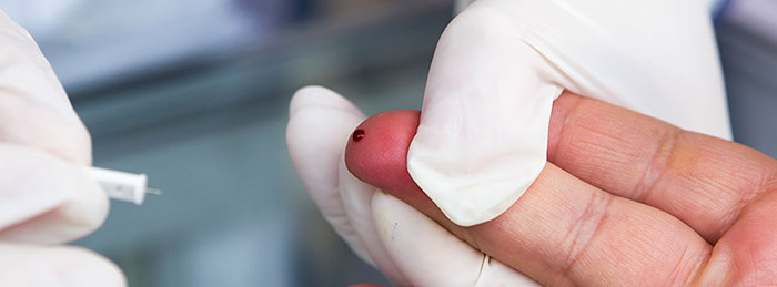 SP tem campanha com mil testes para detecção de hepatites B e C